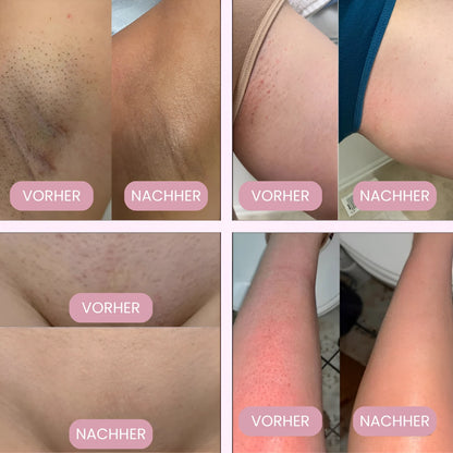 Luxeon Damenrasierer Pro