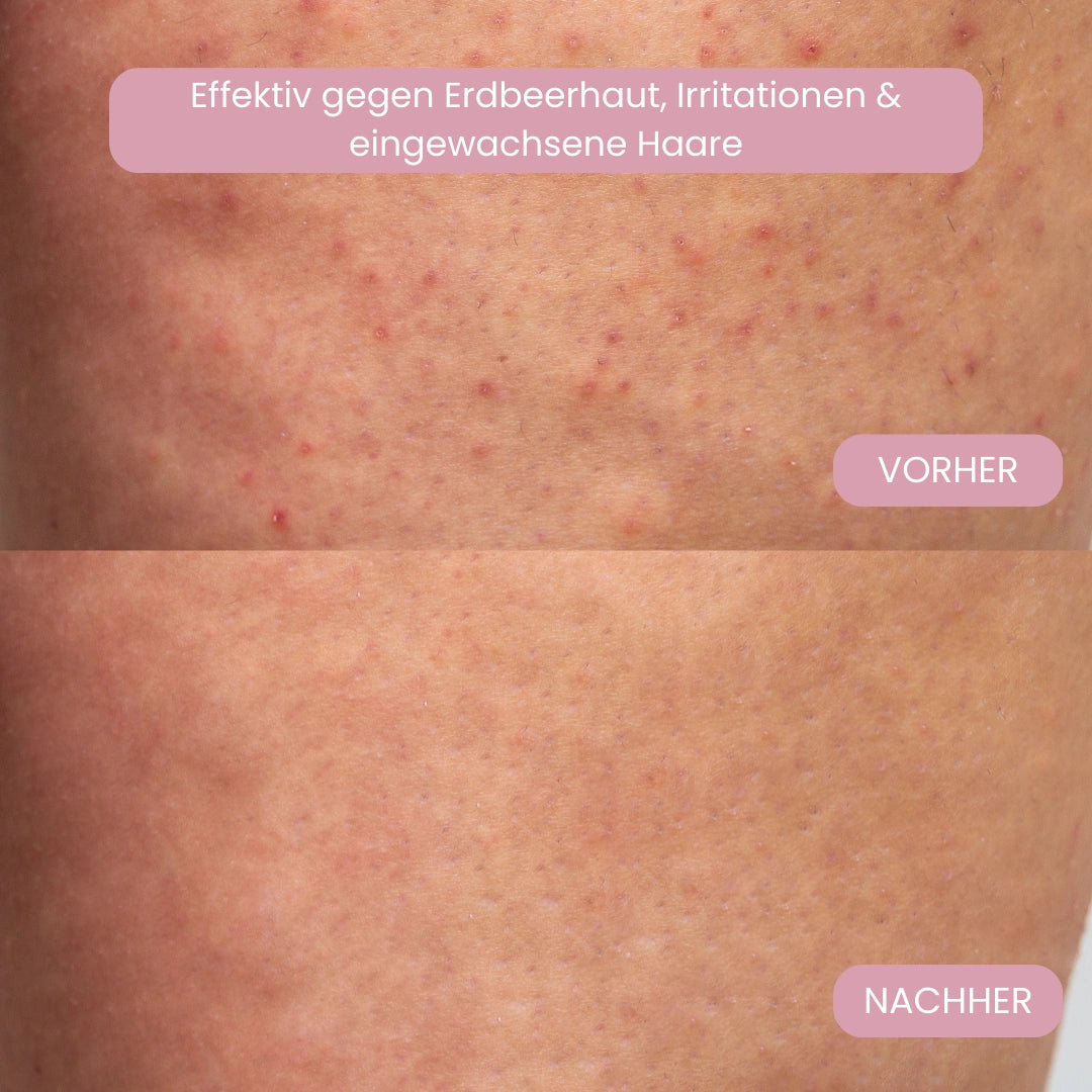 Luxeon Damenrasierer Pro