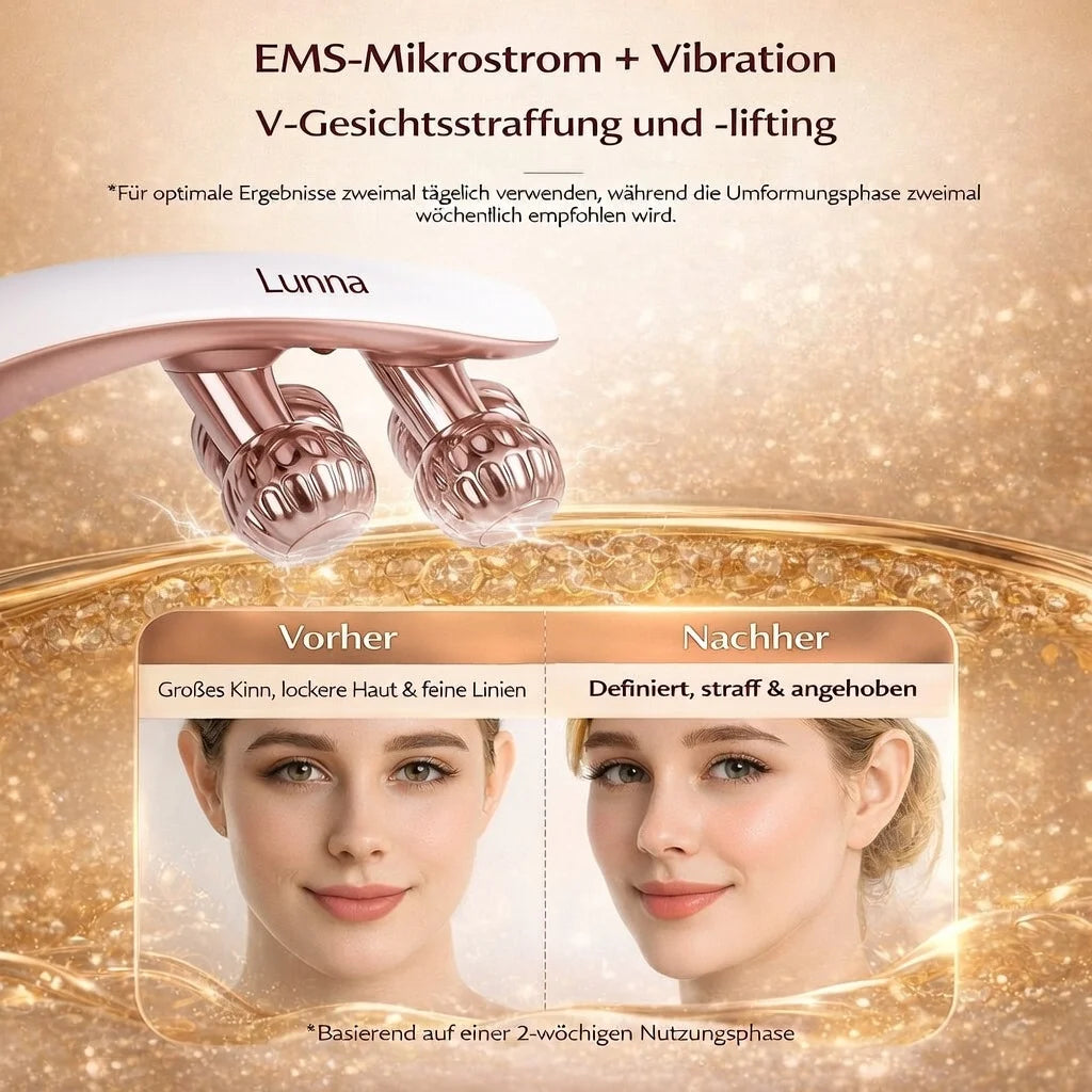 Lunna V-Ray Lift Roller